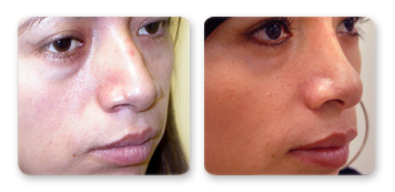 new york skin care cosmetic surgery